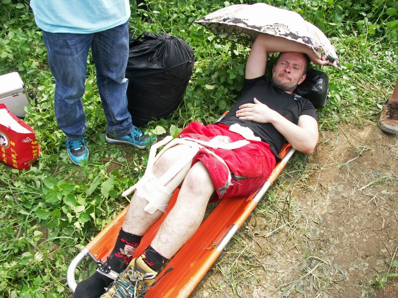 File:24DislocatedLegJumper.jpg